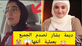 عاجل!! شاهدوا كيف أصبح شكل أنف ديمة بشار بعد عملية التجميل