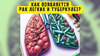 Как появляется рак легких и туберкулез на самом деле