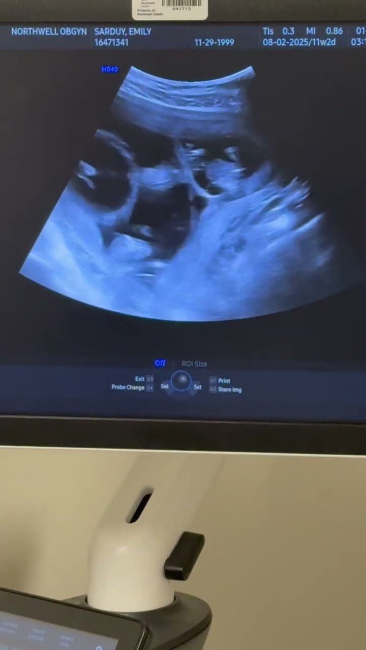 Mom Learns She's Having Quadruplets || ViralHog