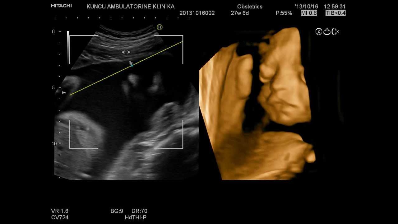 My baby 4D ultrasound 28weeks (part3) - YouTube