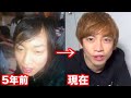 ハゲたくない人は絶対見てください！【ハゲ対策】