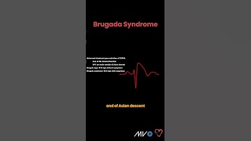 Brugada Syndrome