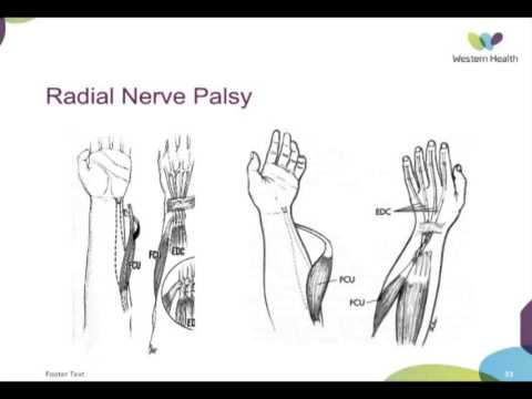 Get Upper Limb Tendon Transfers By Dr Scott Tulloch Youtube Desktop Wallpaper Free Wallpaper Upper Limb Tendon Transfers By Dr Scott Tulloch Youtube For Android Free