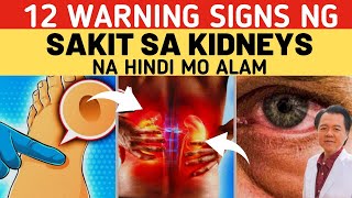 12 Warning Signs ng Sakit sa Kidneys Na Hindi Mo Pa Alam - Payo ni Doc Willie Ong