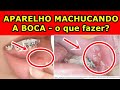 Aparelho Ortodôntico machucando a boca - o que fazer?