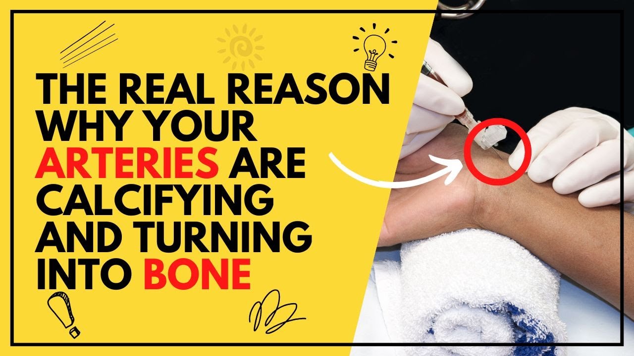 The REAL Reason Why Your Arteries are Calcifying and Turning into Bone ...