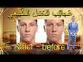 كيف تجعل الجروح والحروق وأثار حب الشباب تختفي من الوجه والجسم وألى الأبد للنساء والرجال
