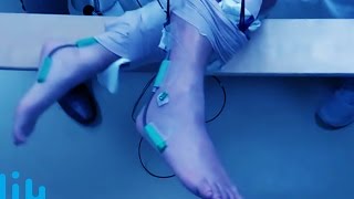 Paralyzed Man Walks Again   Mind Blow #98