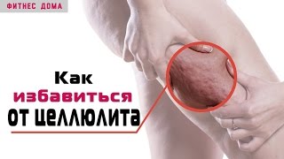 видео Какие тренировки помогут избавиться от целлюлита?