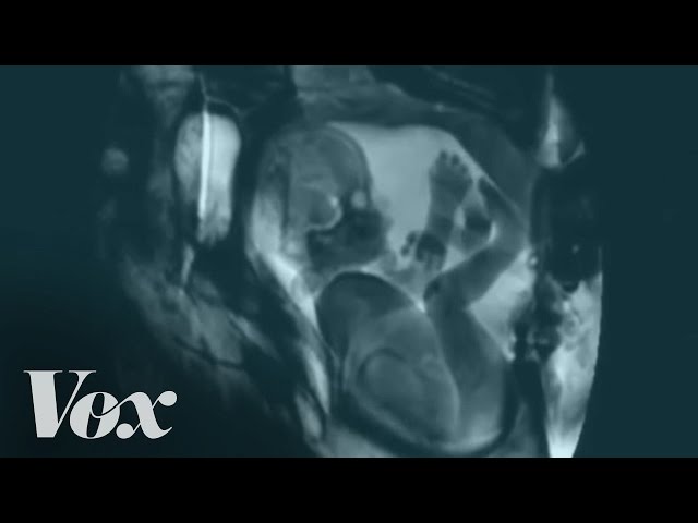 Pity, cat scans of couple having sex thanks Speaking, did cat scans of couple having sex
