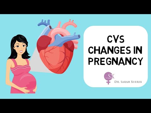 Cardiovascular Changes in Pregnancy