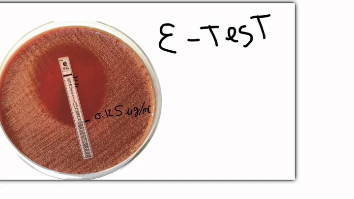 Antibiotics:  Antimicrobial pharmacology (USMLE Step 1 Prep)