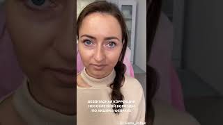 Безопасная коррекция носослезной борозды: избавляемся от темных кругов и мешков под глазами