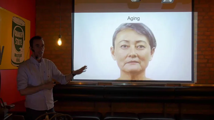 Novel approaches for the treatment of aging - Prof...