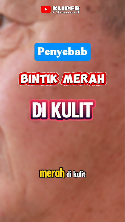 Penyebab Bintik Merah Di Kulit #kulit #kliperchannel #shorts