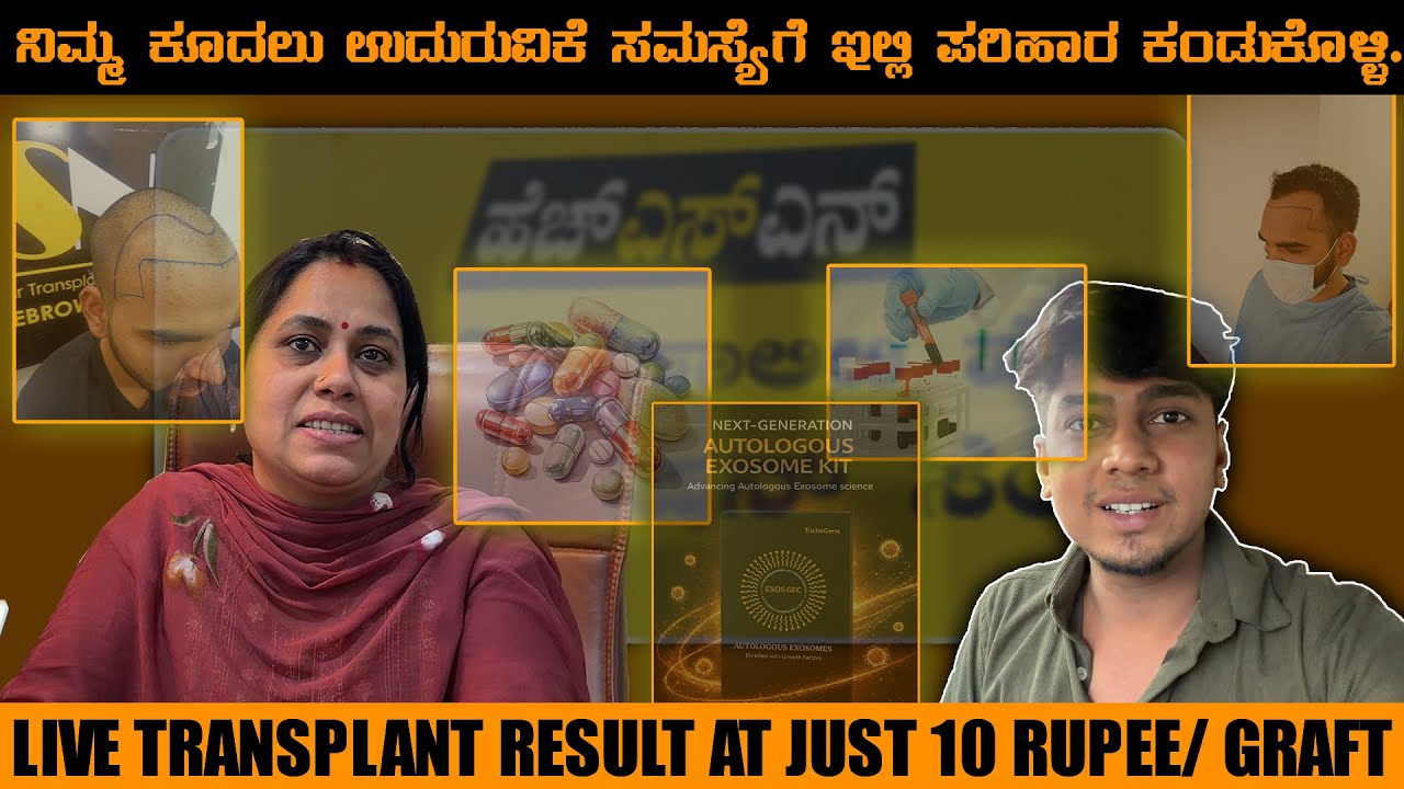 ₹10/- BEST PRICE IN KARNATAKA FOR HAIR TRANSPLANT AND BEARD TRANSPLAT || HSN HAIR TRANSPLANT