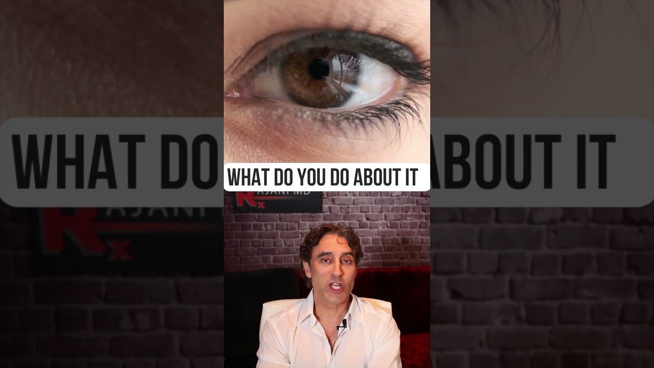 Is YOUR RETINOL MAKING RED EYES?? 