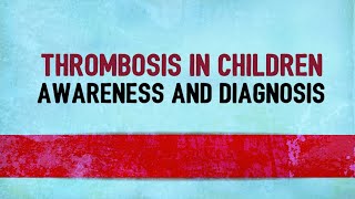 Thrombosis in children: Awareness and diagnosis (DVT)