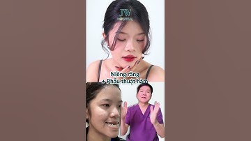 HẾT HÔ MÓM VĨNH VIỄN Bác sĩ Tú Dung tặng 3 GIẢI PHÁP VÀNG điều trị DỨT ĐIỂM