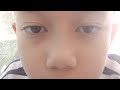 Every live 🔴 watching [short] 22 minutes