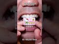Satisfying Chewing ASMR #Compilation #ASMR #DoctorTristanPeh
