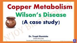 Copper metabolism & Associated Disorders | Mineral Metabolism |Biochemistry |N'JOY Biochemistry