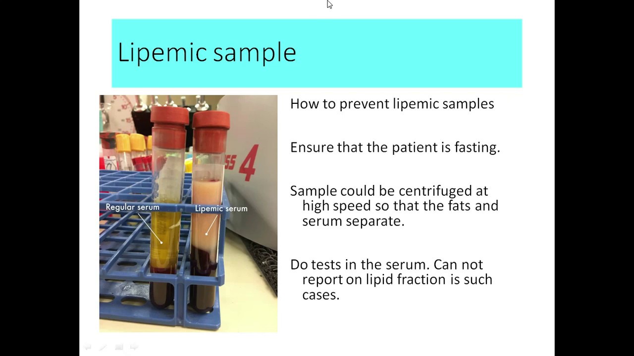 pre-analytical-error-youtube