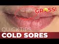 Negative Side Effects of Permanent Lip Makeup: Cold Sores Quick Tips