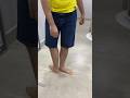 Renato Bayma Gaia from Brazil can rotate his foot 210.66 degrees 😲