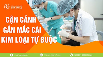 Cận cảnh gắn mắc cài kim loại tự buộc thông minh