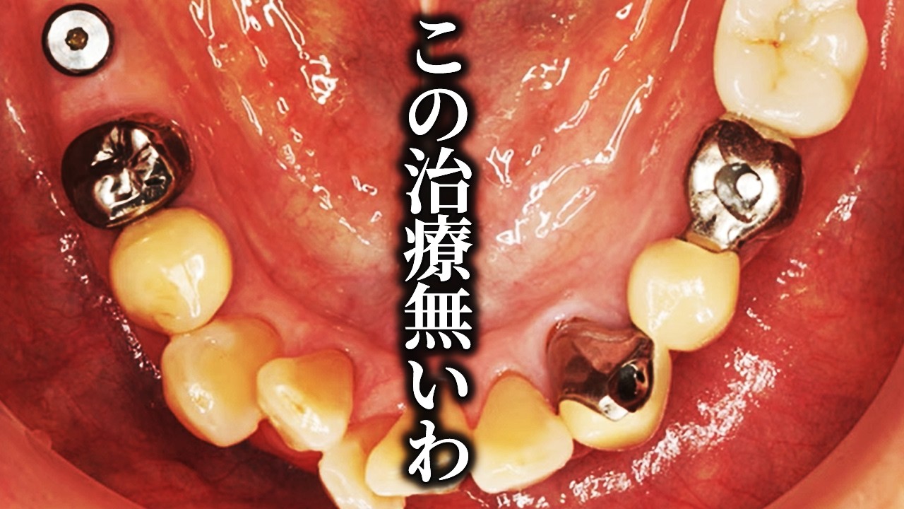 【マジギレ】治療途中で放置された方をアスクラピアの名にかけて救いました