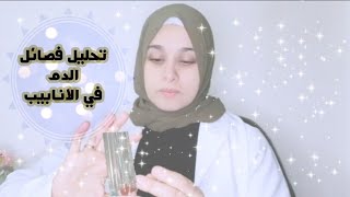 تحليل فصائل الدم وعامل ريزوس في الانابيب مع غسل الدم ABO test & RH in tube method