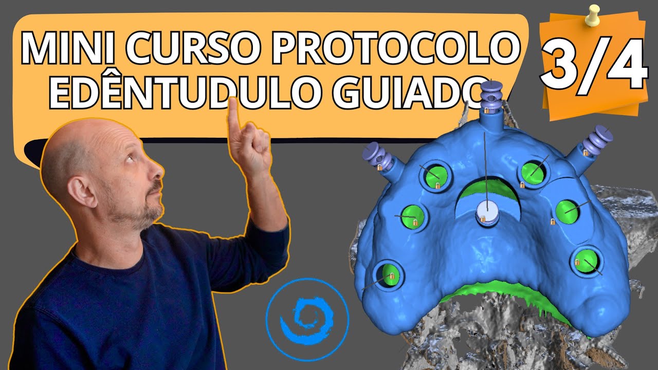 Mini curso completo como desenhar guia cirúrgico para edêntulo total no BlueSkyBio 3 4