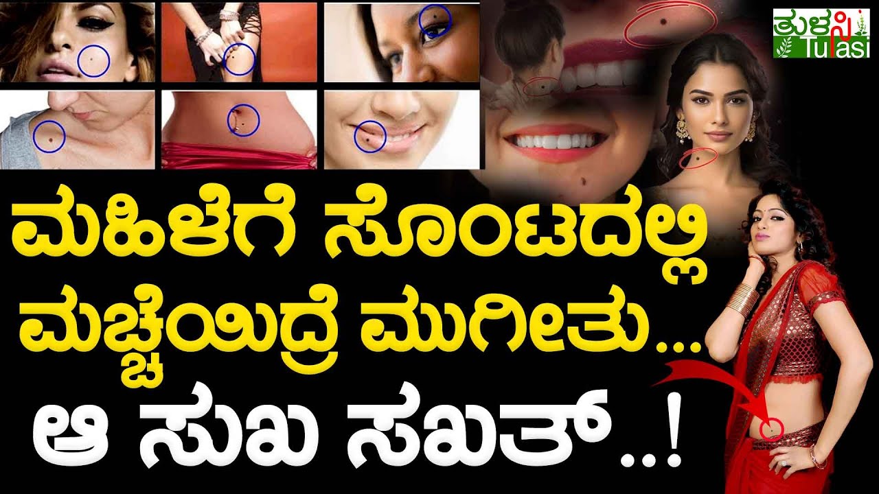 Lucky Moles on Female Body |ಮಹಿಳೆಯರ ಈ ಭಾಗದಲ್ಲಿ ಮಚ್ಚೆ ಇದ್ದರೆ ಶುಭವಂತೆ! | Secrets of Moles in Astrology