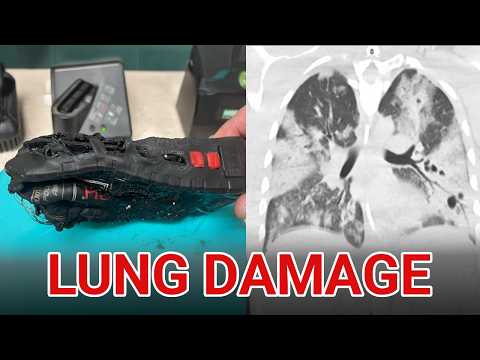 Ref:lADLvwAJs-c Lithium-Ion Hospitalizes Firefighter: Hydrogen Fluoride