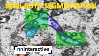 How to segment your vEM Semi-automatic segmentation and ground truth using nnInteractive