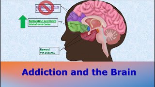 How Does Addiction Affect the Brain
