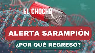 Sarampión: Lo que está pasando ahora | El chocho  #adnnoticiasradio