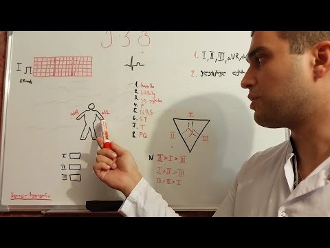ვსწავლობთ ელექტროკარდიოგრამას | ე.კ.გ ნაწილი 2