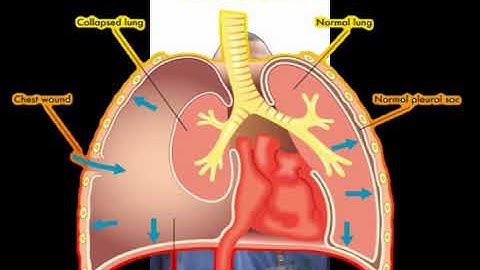 #ATLS ATLS BASICS - BREATHING