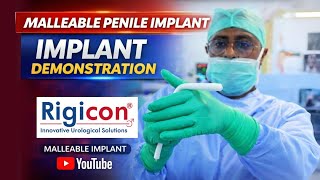 Rigicon Malleable Penile Implant | Permanent Solution for Erectile Dysfunction