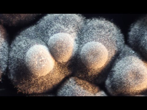 Streptomyces, bacteria that look like moulds.