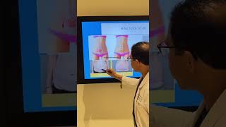 Tummy Tuck vs. Mini Tummy Tuck | Dr. Saul Lahijani MD | Beverly Hills Institute of Plastic Surgery