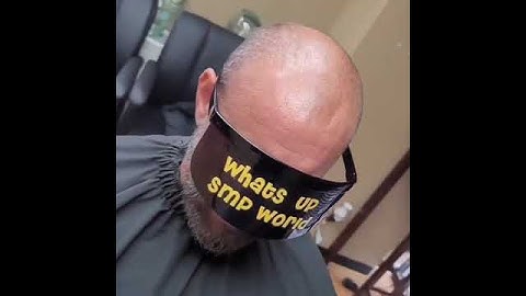 Scalp Micropigmentation results