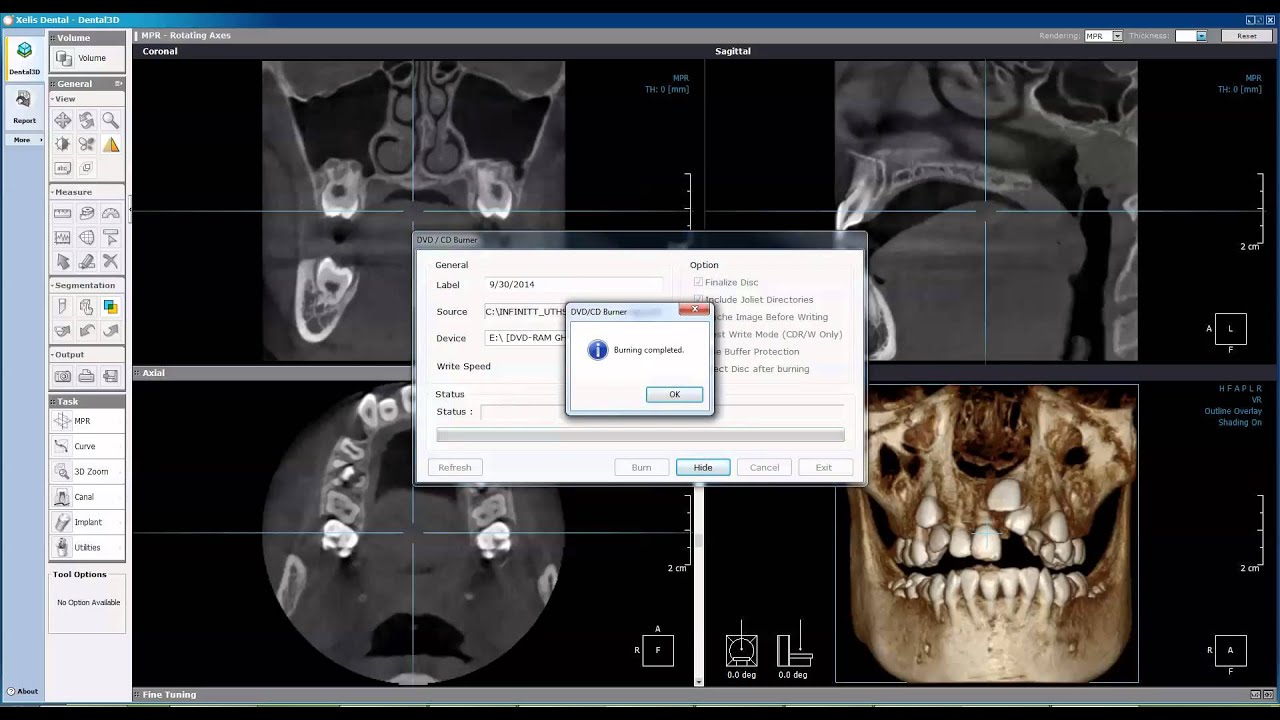 xelis dental cd viewer