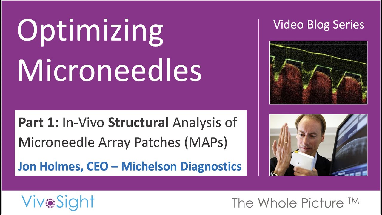 Optimization of Microneedle Array Patches (MAPs). Part 1: In-Vivo ...