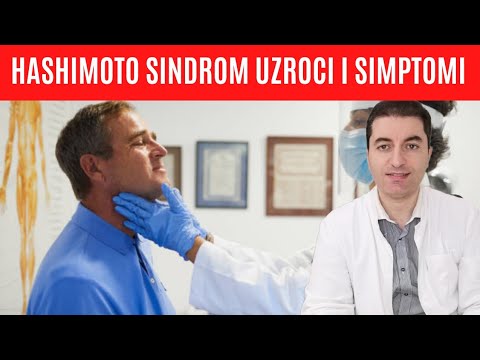 Video: Hashimotova Guša (hashimoto) - Uzroci, Simptomi I Liječenje