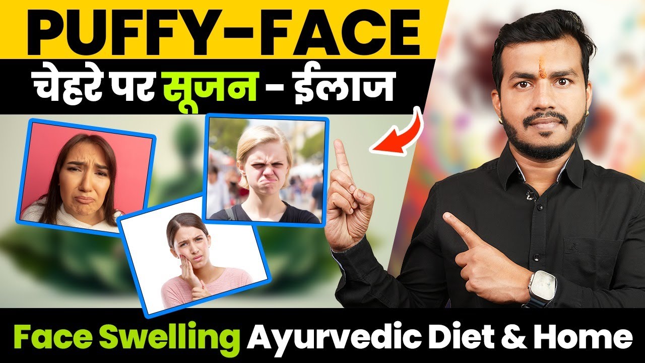 352Puffy Face (चेहरे पर सूजन) Kyu Hoti H Aur Uska Best IlaajFace