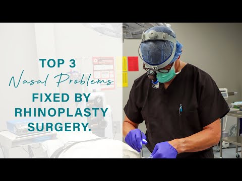 Video thumbnail: Top 3 Nasal Problems fixed by Rhinoplasty Surgery  | Facial Plastic Surgeon — Smith Facial Plastics