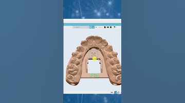 Maestro 3D | Dental Studio Expert |  How to add Fixture Labels | Automating Clear Aligner Trimming